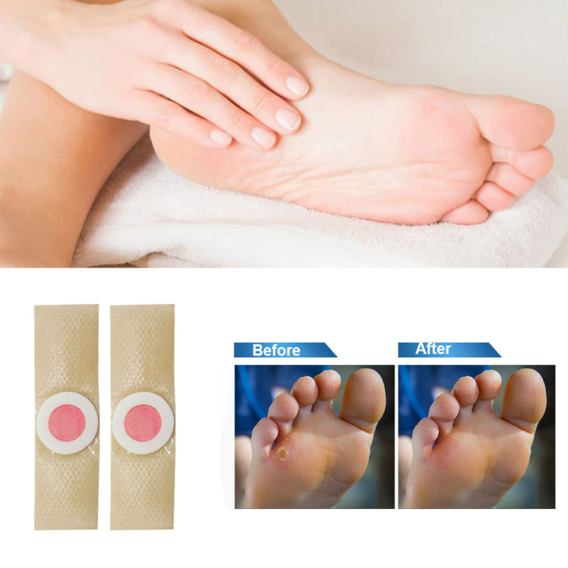 50Pcs Corn Remover Plaster Pads for Feet