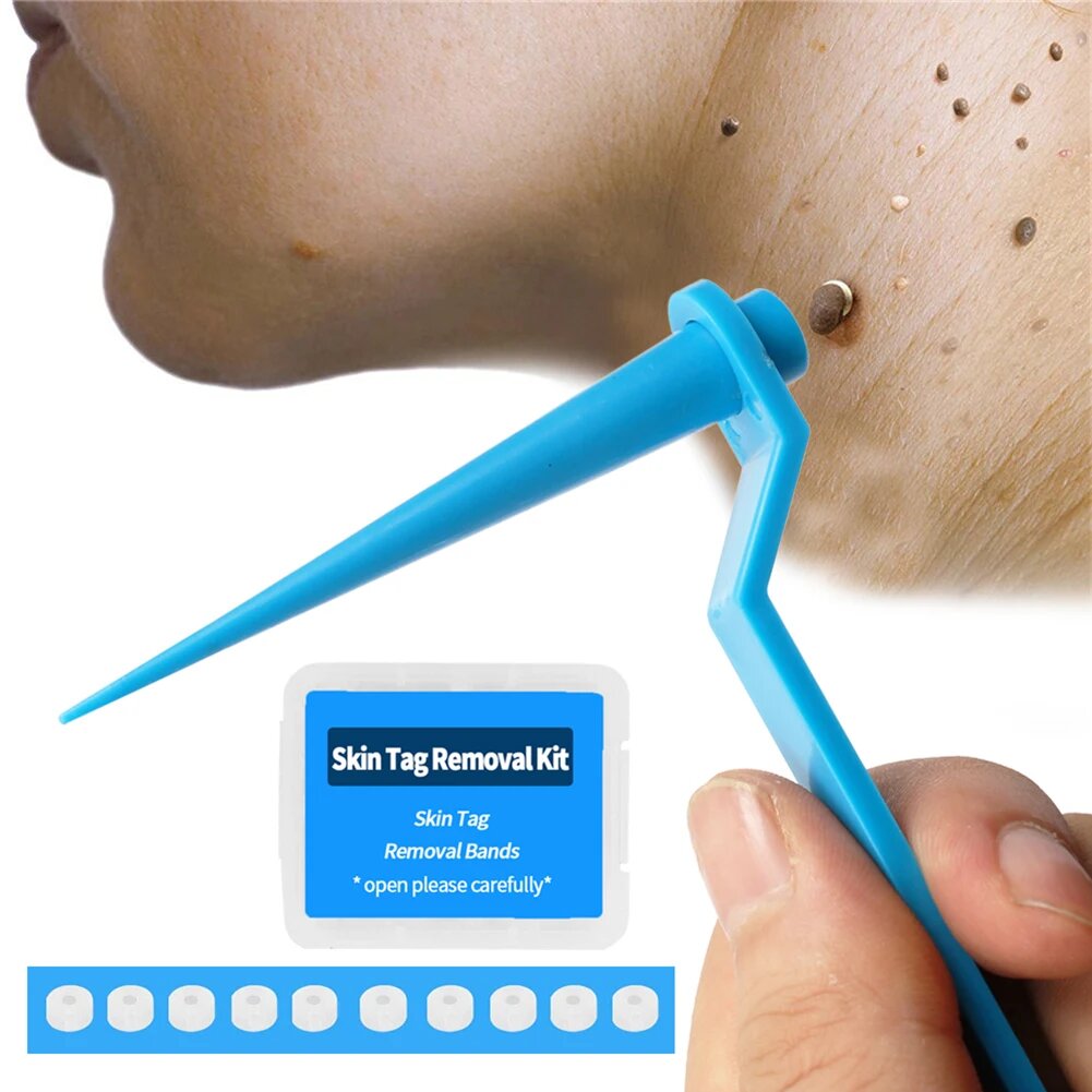 Skin Tags Removal Patches-Wart Removal Kit