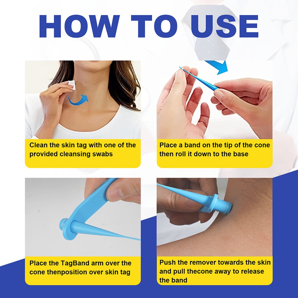 Skin Tags Removal Patches-Wart Removal Kit