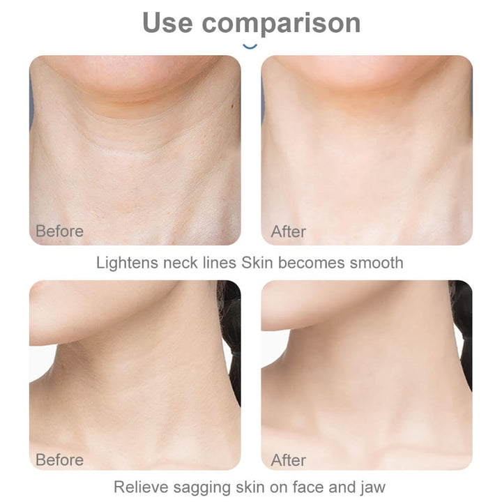Photon LED Neck Massager - Neck Lifting And Anti Wrinkles