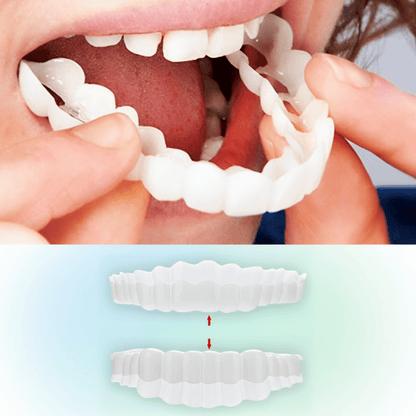 Snap On Custom Fit Dental Veneers Cosmetic Smile