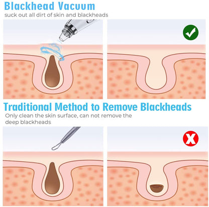 Professional and Newest Blackhead Vacuum Cleaner