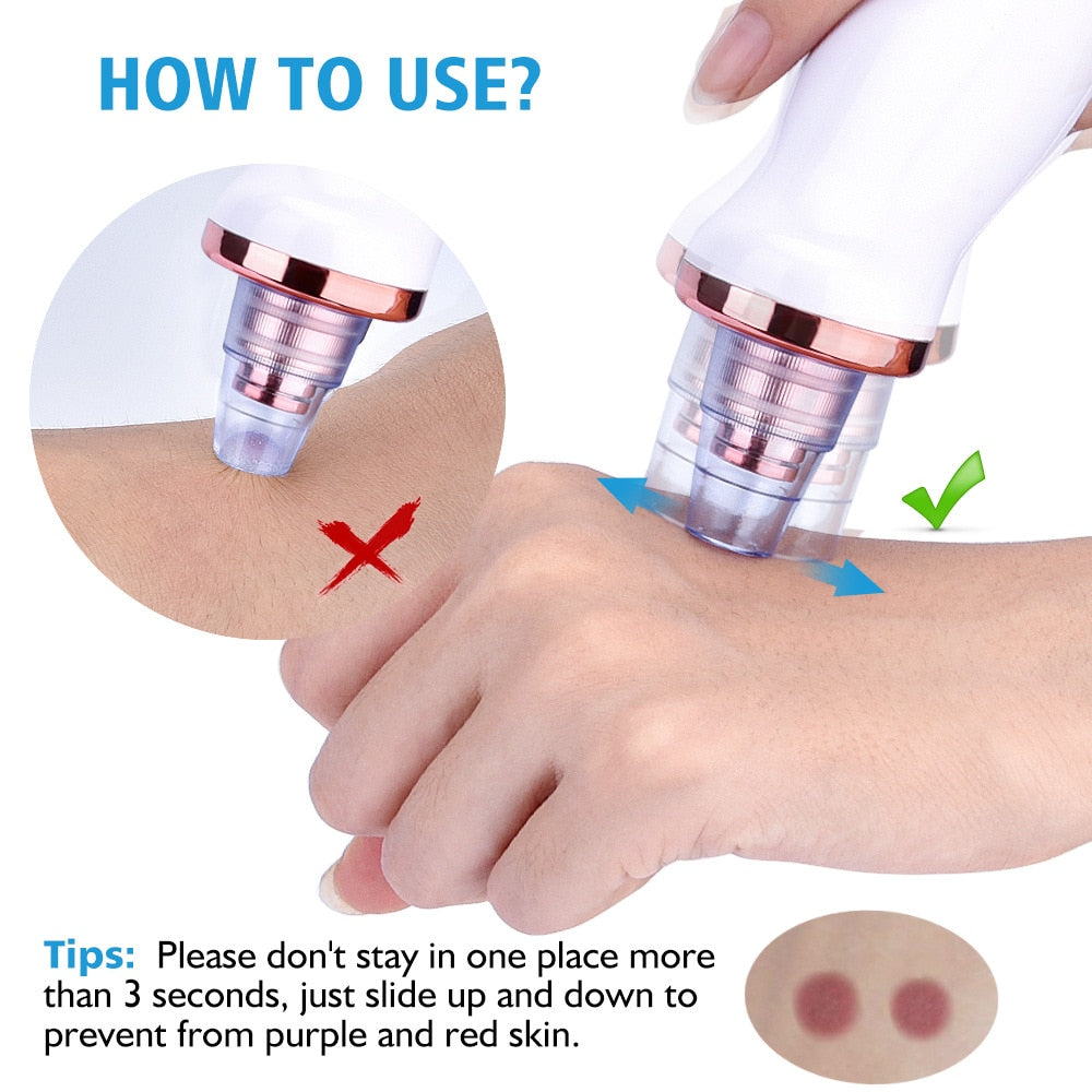 Electric Blackhead Remover Kit