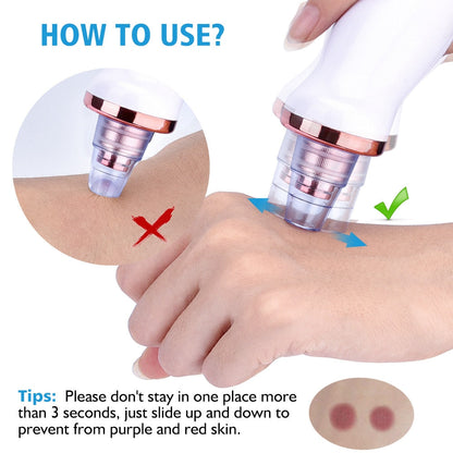 Electric Blackhead Remover Kit
